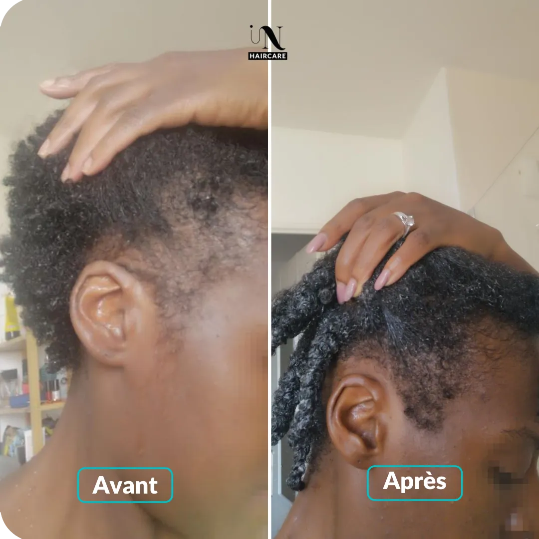 avant-apres-inhaircare